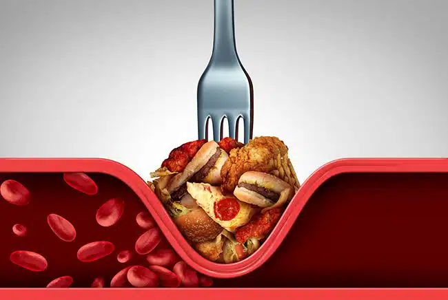 9 příznaků vysokého cholesterolu
